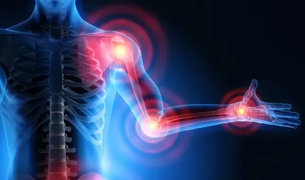 Arthrose, mon ami ! (Oui, l'arthrose n'est pas réellement votre ennemi)